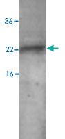 Anti-CNTF Rabbit Polyclonal Antibody