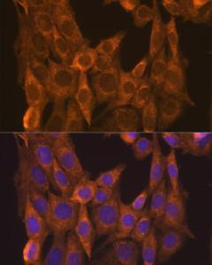 Immunofluorescence analysis of NIH/3T3 cells using Anti-Retinoic Acid Receptor alpha Antibody (A12622) at a dilution of 1:100 (40X lens). DAPI was used to stain the cell nuclei (blue)