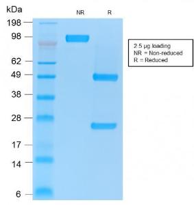 SDS-PAGE analysis of Anti-CD86 Antibody [rC86/1146] under non-reduced and reduced conditions; showing intact IgG and intact heavy and light chains, respectively. SDS-PAGE analysis confirms the integrity and purity of the antibody