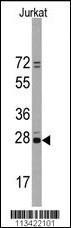 Anti-CD9 Rabbit Polyclonal Antibody (APC (Allophycocyanin))