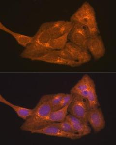 Immunofluorescence analysis of U2OS cells using Anti-Retinoic Acid Receptor alpha Antibody (A12622) at a dilution of 1:100 (40X lens). DAPI was used to stain the cell nuclei (blue)