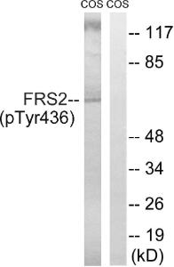 Western blot analysis of lysates from COS7 cells using Anti-FRS2 (phospho Tyr436) Antibody. The right hand lane represents a negative control, where the Antibody is blocked by the immunising peptide