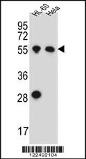 Anti-HAS2 Rabbit Polyclonal Antibody