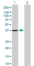 Anti-AKR1C3 Rabbit Polyclonal Antibody