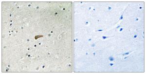 Immunohistochemical analysis of paraffin-embedded human brain using Anti-FRS2 (phospho Tyr436) Antibody. The right hand panel represents a negative control, where the Antibody was pre-incubated with the immunising peptide