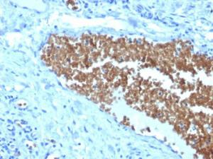 Immunohistochemical analysis of formalin-fixed, paraffin-embedded human tonsil using Anti-alpha 1 Spectrin Antibody [SPTA1/1832]