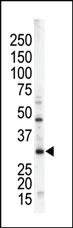 Anti-STK16 Rabbit Polyclonal Antibody