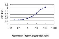 Anti-FOXC2 Mouse Monoclonal Antibody [clone: 2H3]