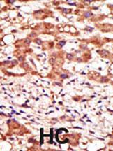 Anti-MGAT1 Rabbit Polyclonal Antibody (HRP (Horseradish Peroxidase))