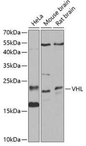 Antibody anti-VHL 100 µl