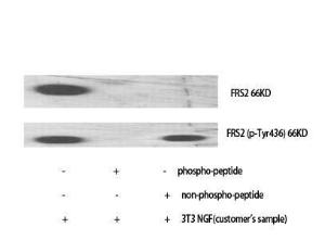 Western blot analysis of various cells using Anti-FRS2 (phospho Tyr436) Antibody