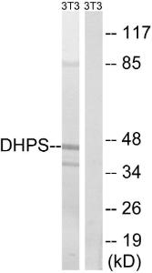 Western blot analysis of lysates from NIH/3T3 cells using Anti-DHPS Antibody. The right hand lane represents a negative control, where the antibody is blocked by the immunising peptide