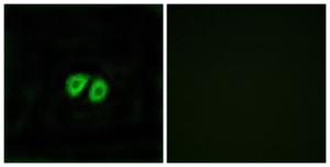 Immunofluorescence analysis of MCF7 cells using Anti-GPR56 Antibody. The right hand panel represents a negative control, where the antibody was pre-incubated with the immunising peptide