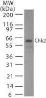 Anti-CHEK2 Mouse Monoclonal Antibody [clone: 73C175.1.1]