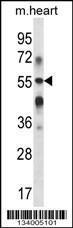 Anti-B3GALT2 Rabbit Polyclonal Antibody (PE (Phycoerythrin))