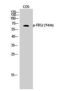 Western blot analysis of COS cells using Anti-FRS2 (phospho Tyr436) Antibody