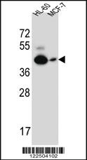 Anti-CALCR Rabbit Polyclonal Antibody