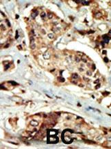 Anti-STK16 Rabbit Polyclonal Antibody