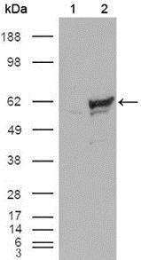 Anti-CHEK1 Mouse Monoclonal Antibody [clone: 2G1D5]