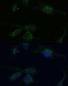 Antibody anti-VHL 100 µl