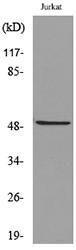 Western blot analysis of lysate from Jurkat cells using Anti-FOXA1 (acetyl Lys265) Antibody