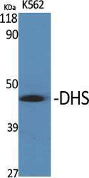 Western blot analysis of various cells using Anti-DHPS Antibody