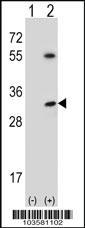 Anti-STK16 Rabbit Polyclonal Antibody