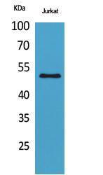 Western blot analysis of Jurkat cells using Anti-FOXA1 (acetyl Lys265) Antibody