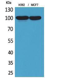 Antibody anti-ENPP3 100 µg