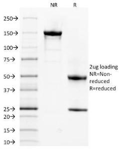 SDS-PAGE analysis of Anti-alpha 1 Spectrin Antibody [SPTA1/1832] under non-reduced and reduced conditions; showing intact IgG and intact heavy and light chains, respectively. SDS-PAGE analysis confirms the integrity and purity of the Antibody