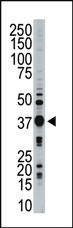 Anti-STK16 Rabbit Polyclonal Antibody