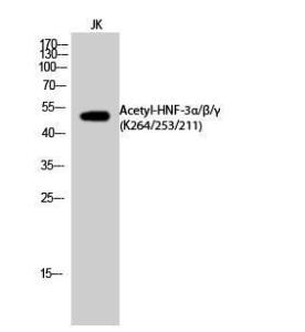 Western blot analysis of JK cells using Anti-FOXA1 (acetyl Lys265) Antibody