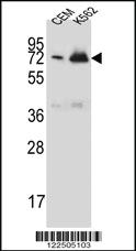 Anti-CFHR5 Rabbit Polyclonal Antibody