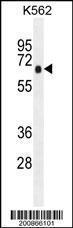 Anti-PRKAA1 Mouse Monoclonal Antibody [clone: 167CT22.1.6]