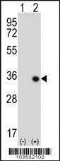 Anti-STK16 Rabbit Polyclonal Antibody