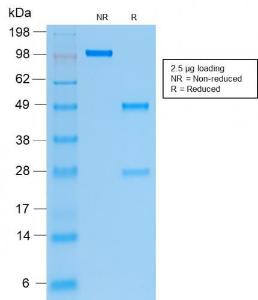 Anti-Cytokeratin 19 antibody