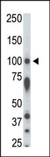 Anti-STK31 Rabbit Polyclonal Antibody