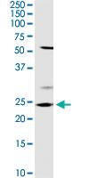 Anti-OTUB2 Rabbit Polyclonal Antibody