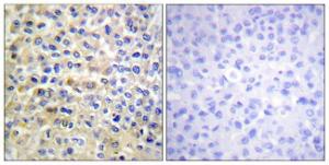 Antibody anti-EGFR A96206-100 100 µg