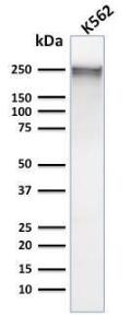 Western blot analysis of human K562 cell lysate using Anti-alpha 1 Spectrin Antibody [SPTA1/1832]