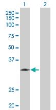 Anti-KLK1 Rabbit Polyclonal Antibody