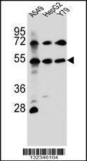 Anti-FGFRL1 Rabbit Polyclonal Antibody (Biotin)