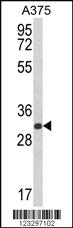 Anti-DERA Rabbit Polyclonal Antibody