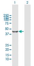 Anti-BHMT2 Rabbit Polyclonal Antibody