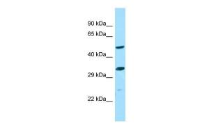 Anti-ALG10B Rabbit Polyclonal Antibody