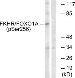 Western blot analysis of lysates from HeLa cells treated with EGF+Serum using Anti-FKHR (phospho Ser256) Antibody. The right hand lane represents a negative control, where the Antibody is blocked by the immunising peptide