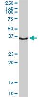 Anti-KLK1 Rabbit Polyclonal Antibody