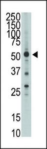 Anti-HTRA1 Rabbit Polyclonal Antibody (Biotin)