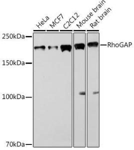 Anti-RhoGAP Rabbit Monoclonal Antibody [clone: ARC1916]