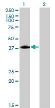 Anti-ISL2 Mouse Monoclonal Antibody [clone: 1D9]